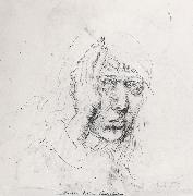 Albrecht Durer Sele-Portrait with Bandage oil painting on canvas